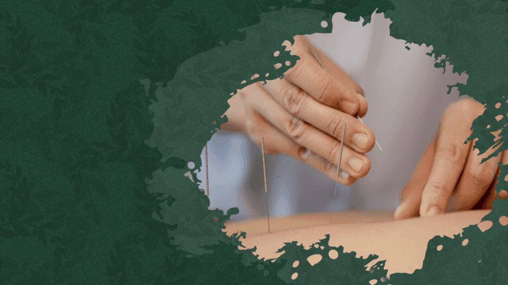 Acupuncture therapy