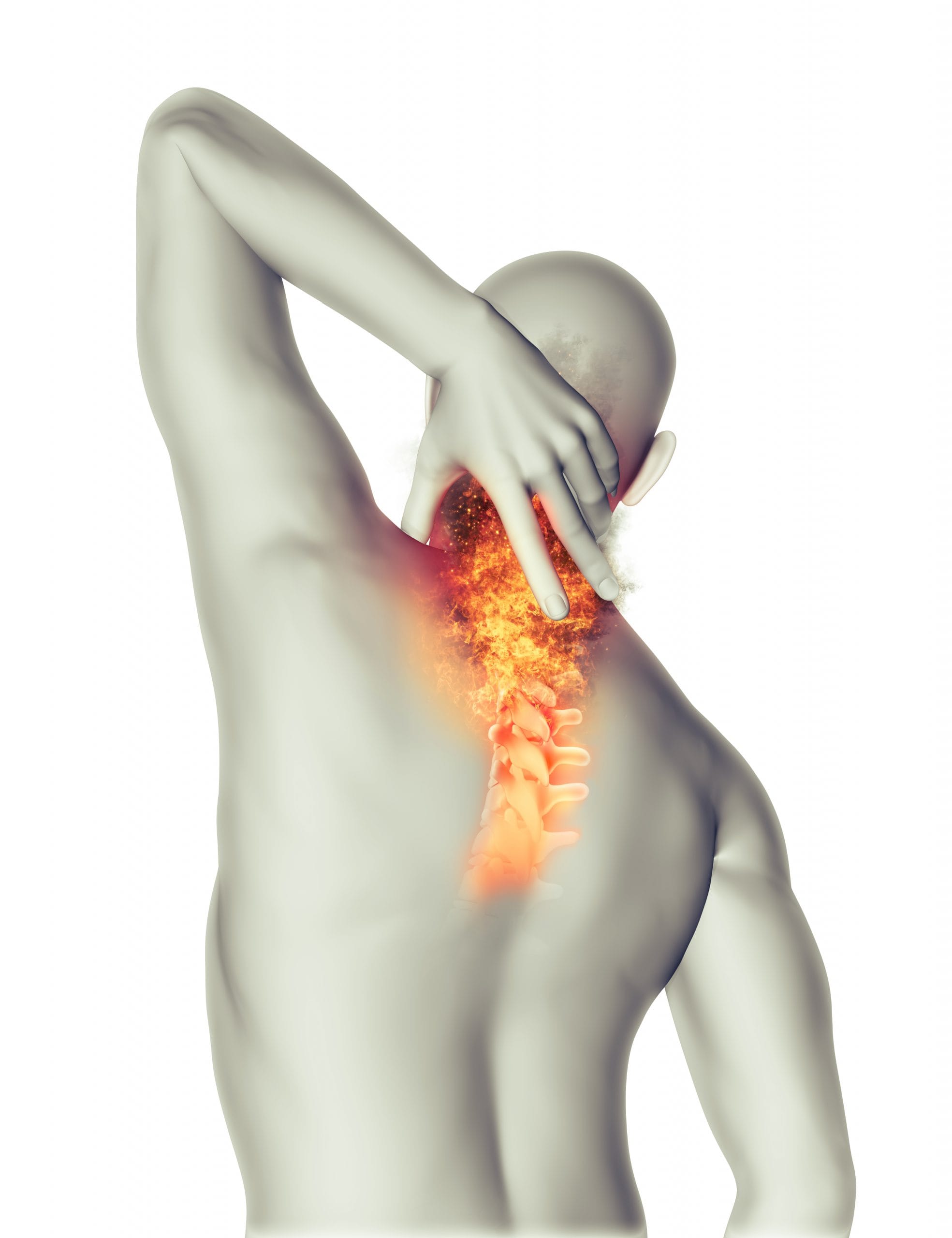 Spine Nerve Compression Treatment
